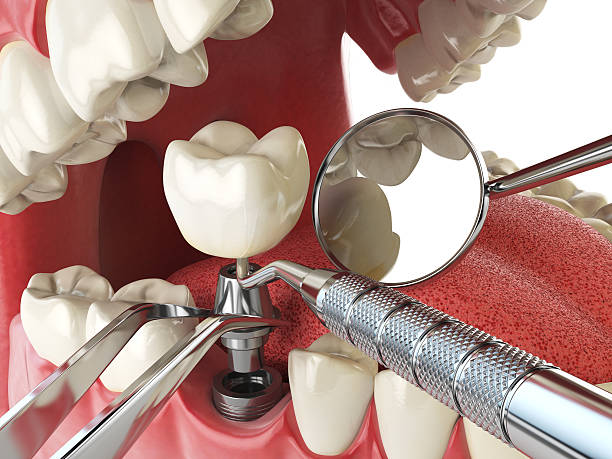 Best Emergency Tooth Extraction in Ashdown, AR